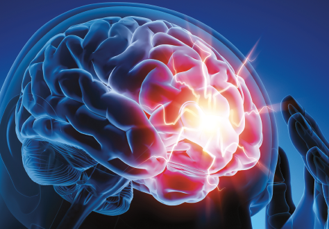 Cerveau
